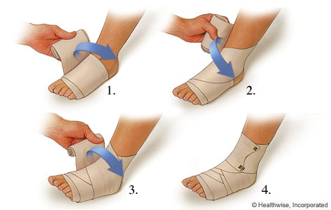 ankle compress